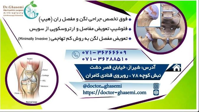 دکتر محمدعلی قاسمی فوق تخصص جراحی لگن و مفصل ران