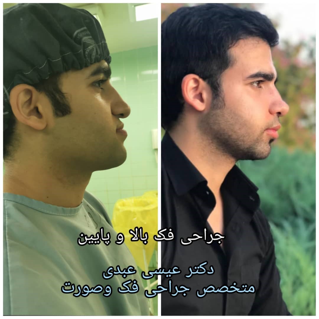 دکتر عیسی عبدی