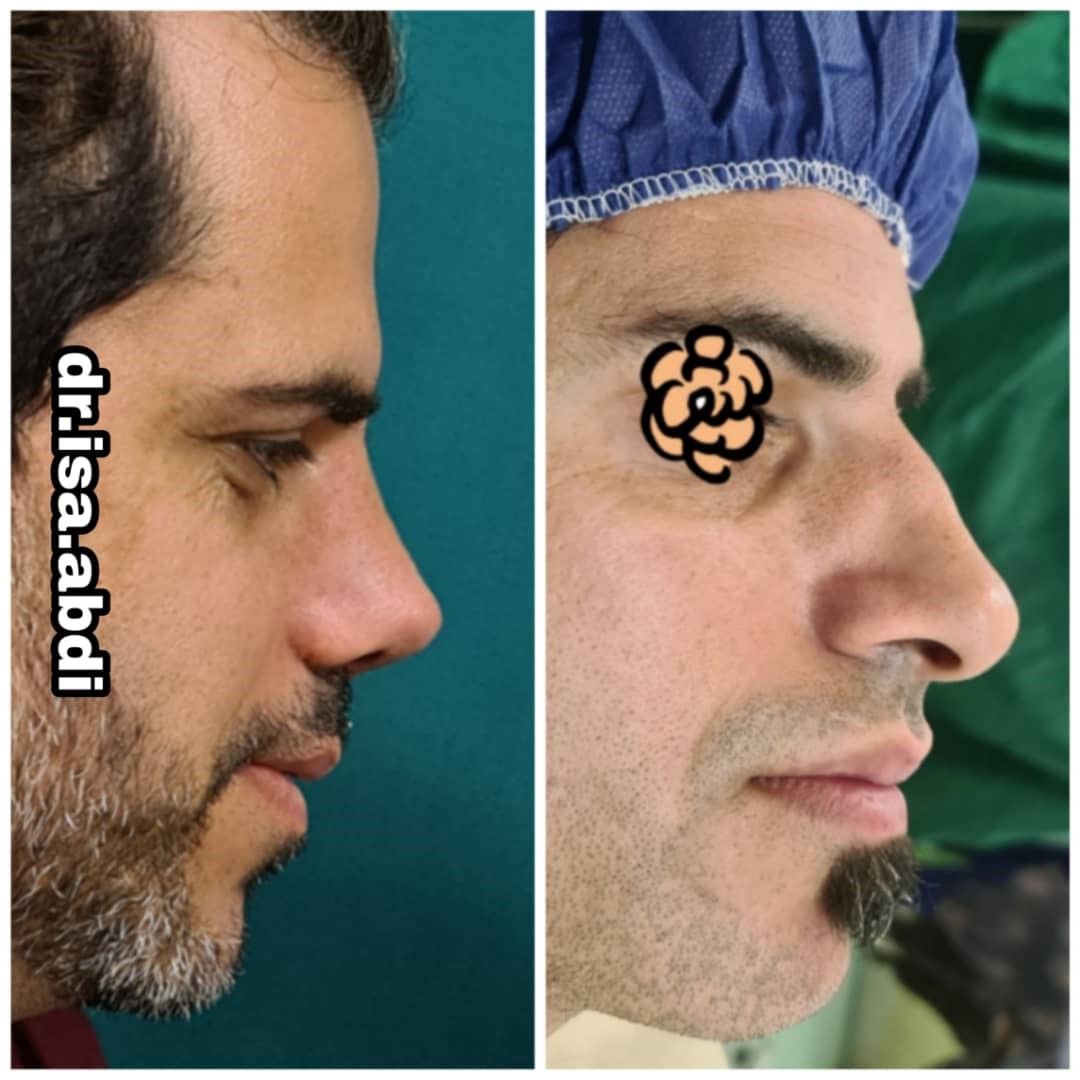 دکتر عیسی عبدی