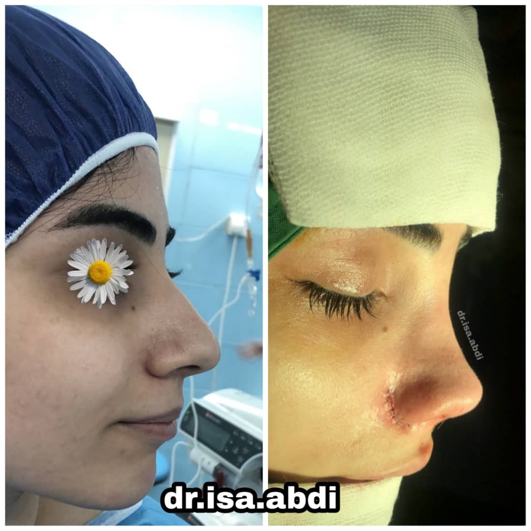 دکتر عیسی عبدی
