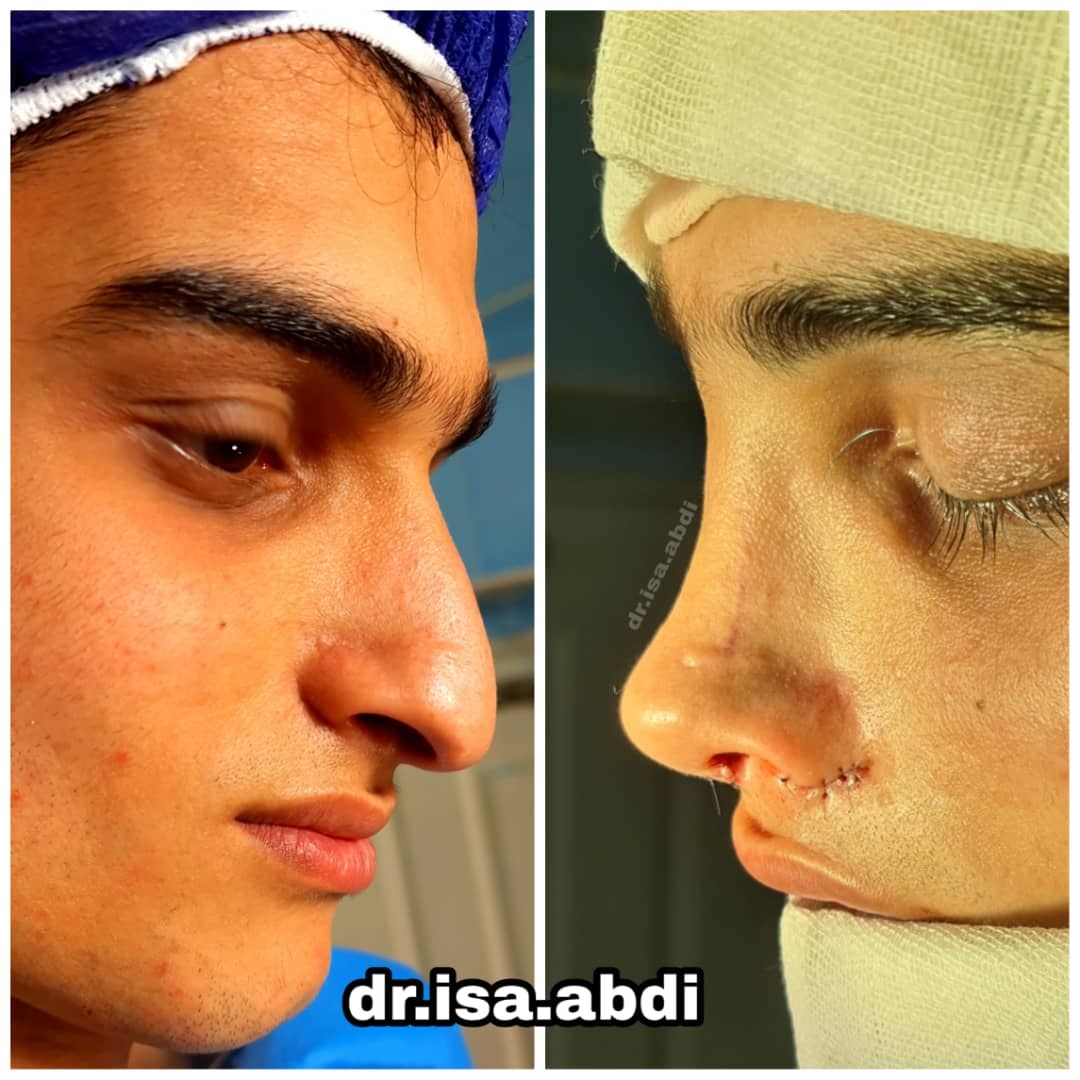 دکتر عیسی عبدی