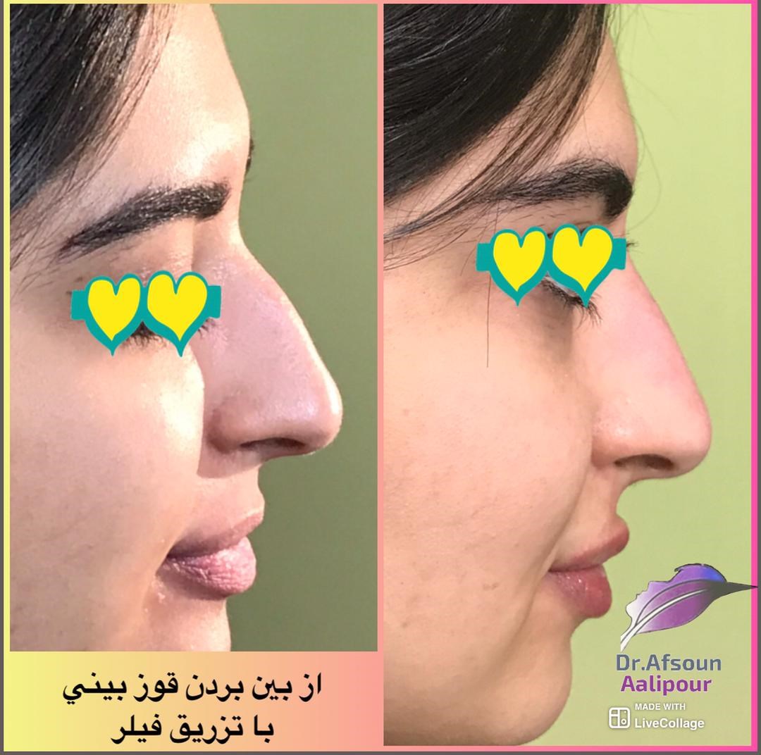 دکتر افسون عالی پور