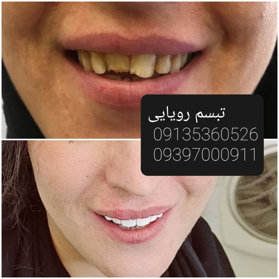 کلینیک دندانپزشکی تبسم رویایی 