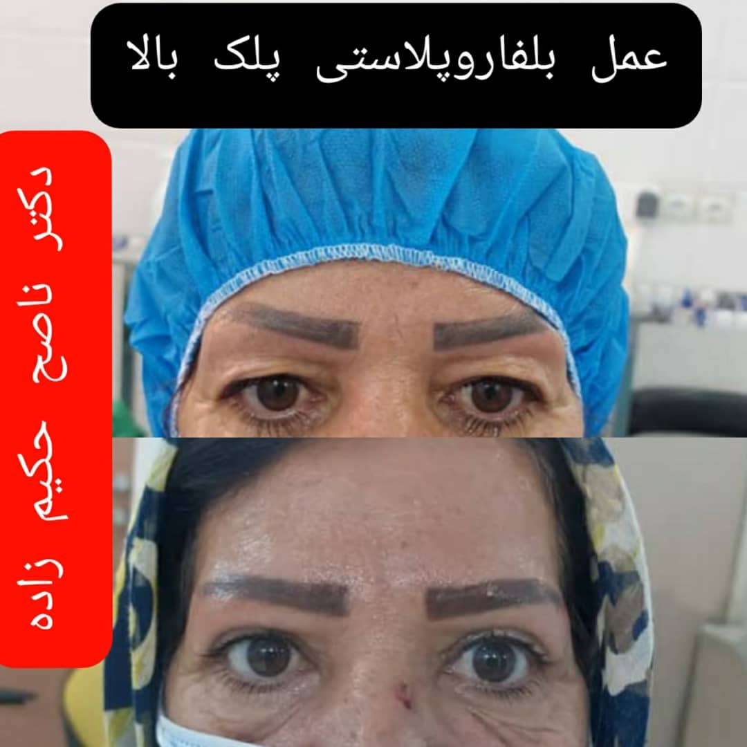  دکتر ناصح حکیم زاده جراح و متخصص بیماری های چشم