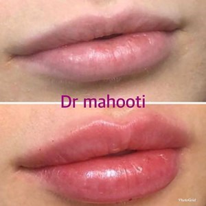 دکتر کامبیز ماهوتی متخصص پوست و مو