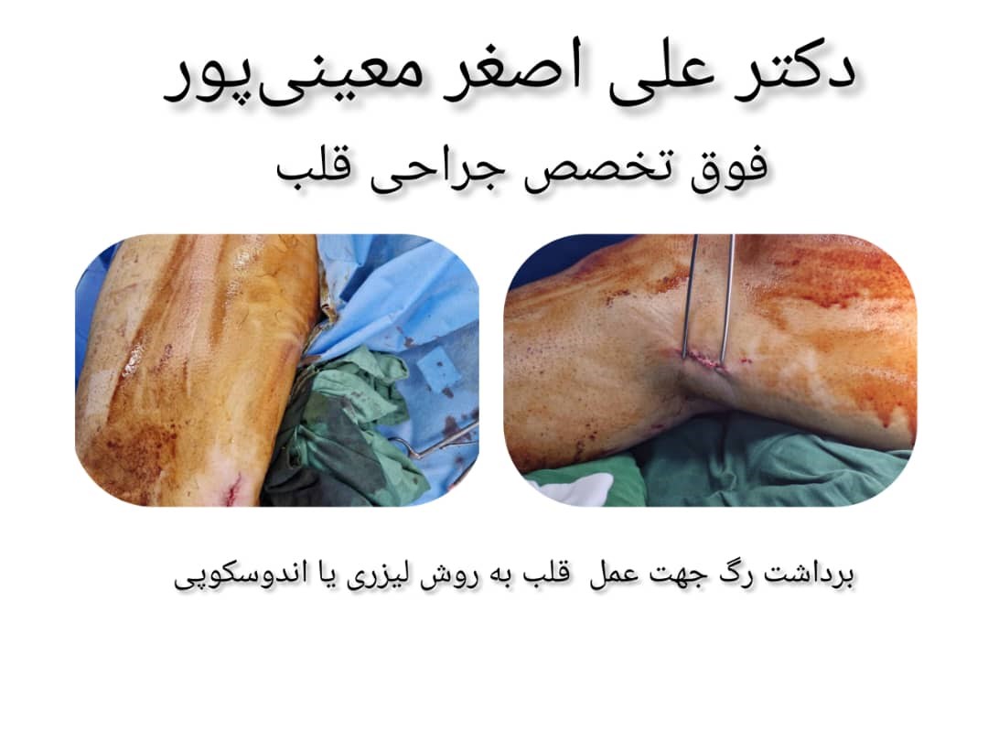 دکتر علی اصغر معینی پور 